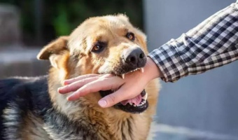 حیوان گزیدگی و حمله سگ هار وآموزه ها برای عموم